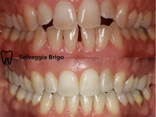 ' .  addslashes(Dottoressa Selvaggia Brigo) . '